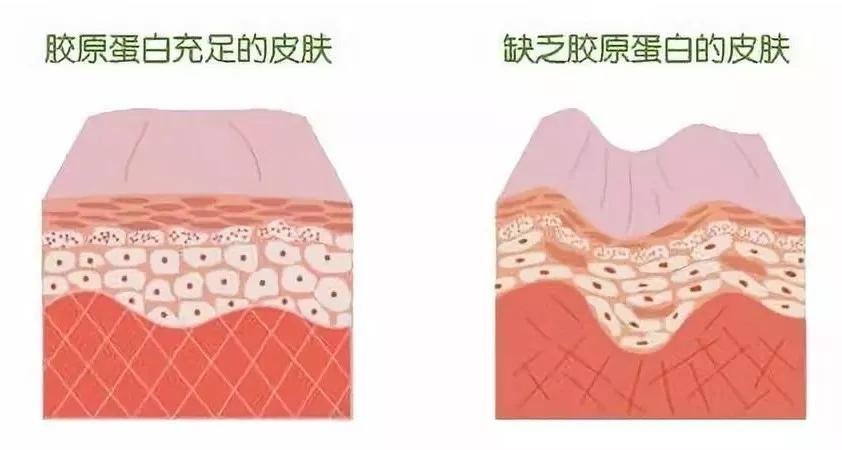 杏仁医生：黑眼圈只是熬夜熬出来的？没那么简单，医生教你如何防治！