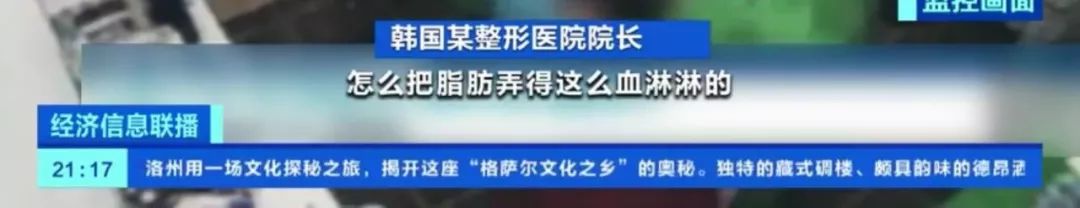 [视觉志]整容手术监控画面曝光：你这是要脸，还是要命？