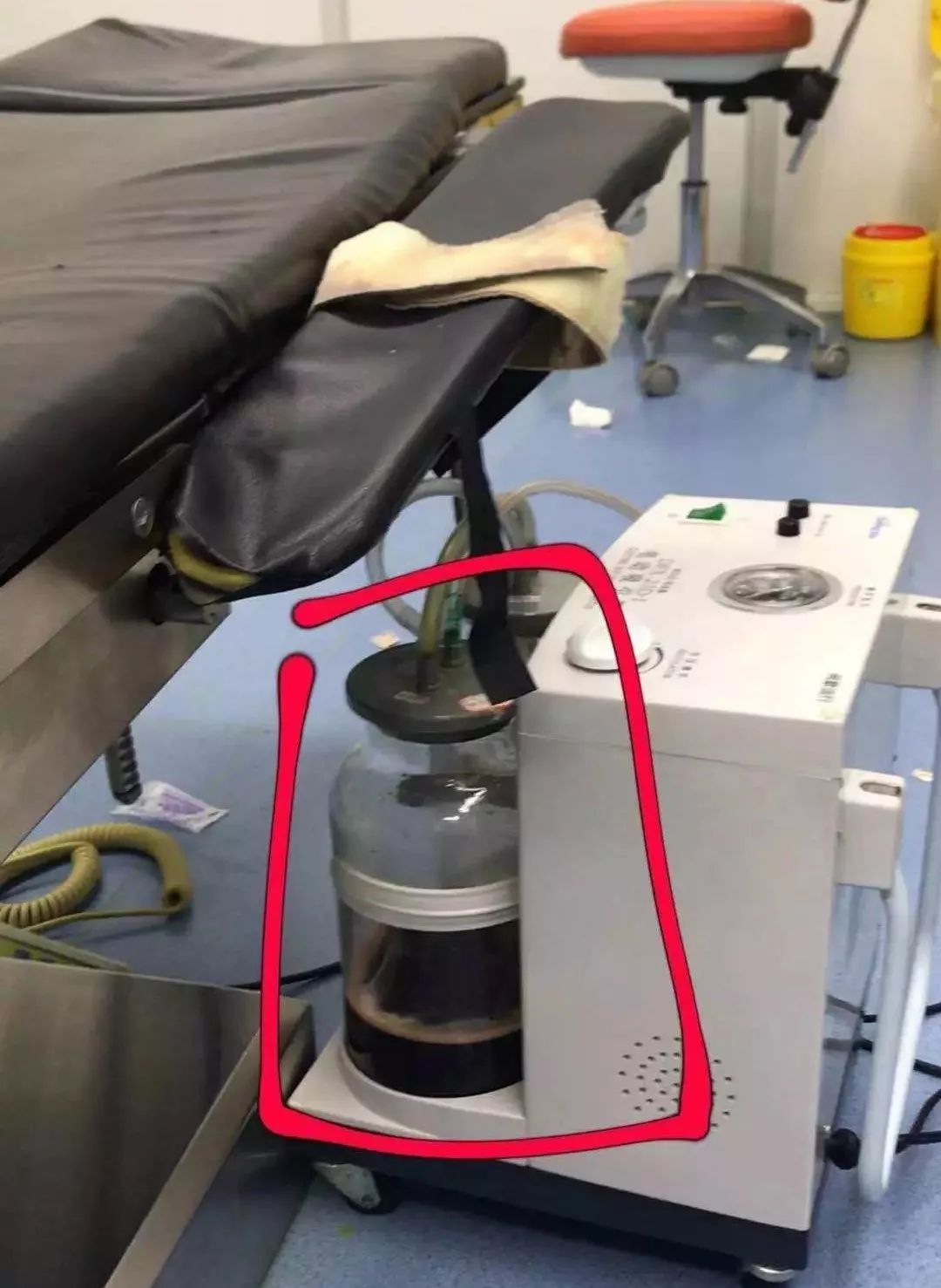 [视觉志]整容手术监控画面曝光：你这是要脸，还是要命？