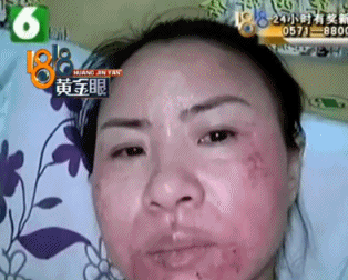 [视觉志]整容手术监控画面曝光：你这是要脸，还是要命？