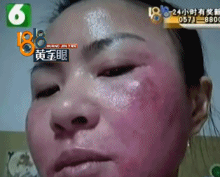 [视觉志]整容手术监控画面曝光：你这是要脸，还是要命？