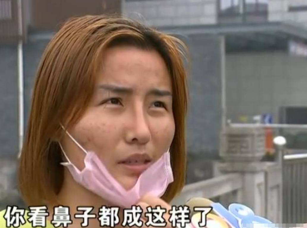 「海峡消费报」花2万多割了双眼皮，术后却成三眼皮？女子：是他拉我去喝酒的