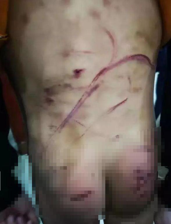 半岛晨报■触目惊心！警方已经介入！