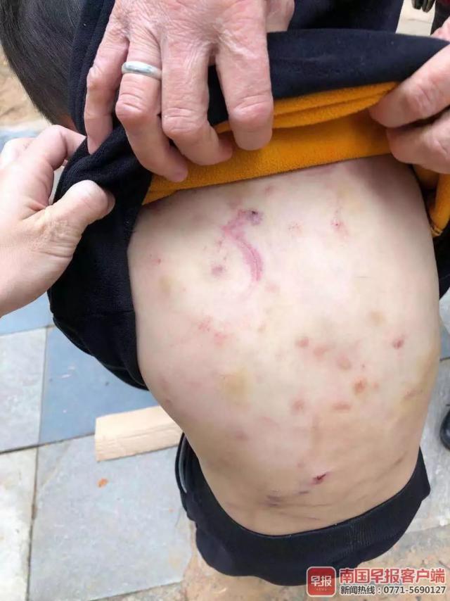 半岛晨报■触目惊心！警方已经介入！