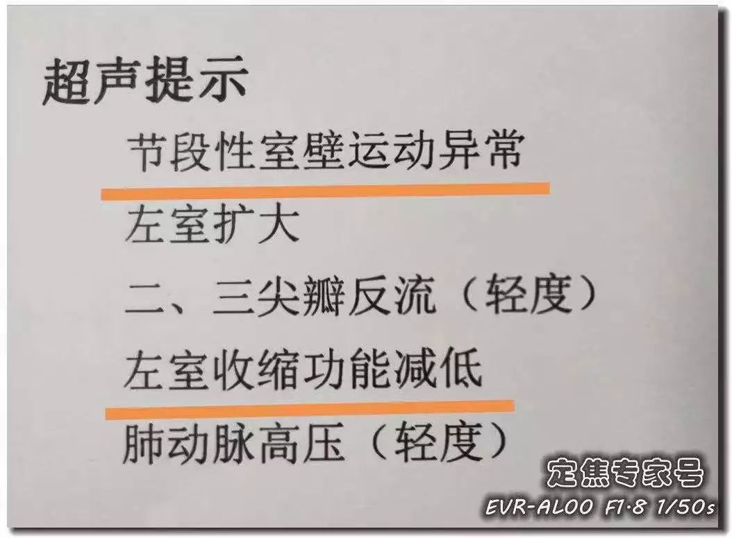 [人民日报]「提醒」从“上火”到心肌死亡仅5天！牢记16字，必要时能救命！
