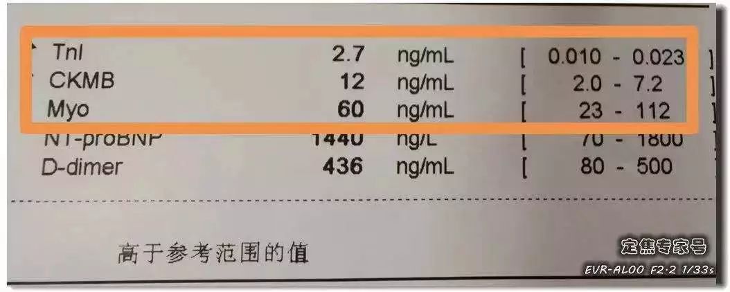 [人民日报]「提醒」从“上火”到心肌死亡仅5天！牢记16字，必要时能救命！