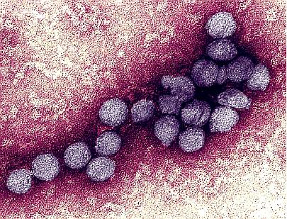 那些人类历史上流行的瘟疫