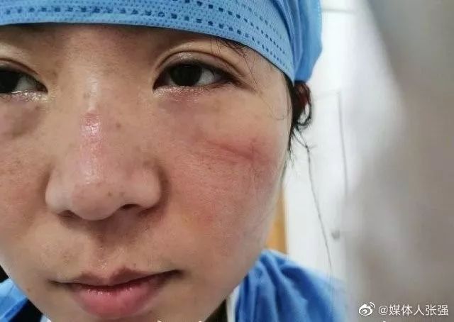 人民日报@她们摘下口罩的样子，让人心疼……