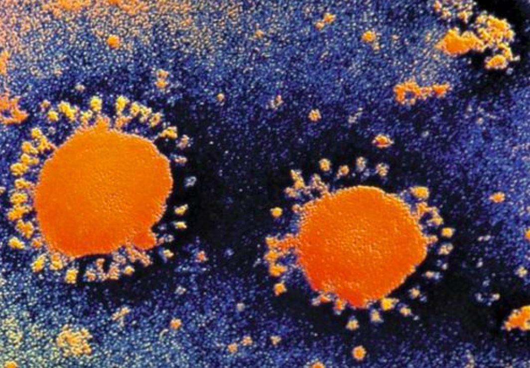 【新周刊】我是病毒，只输给恐惧并尊重我的人