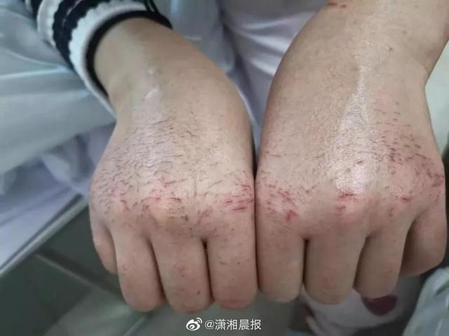 [读者]钟南山、李兰娟成全民偶像背后：我看清了3个真相