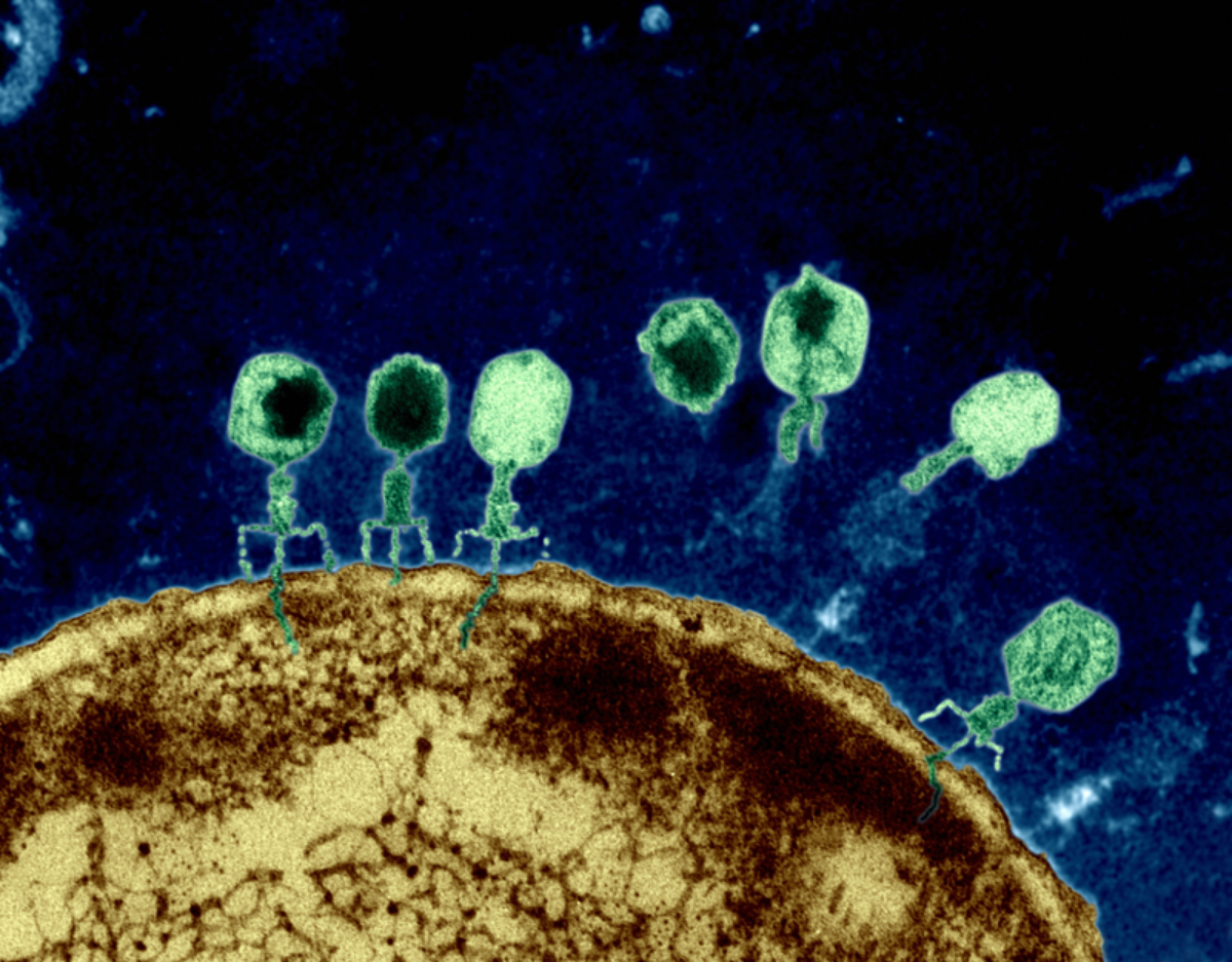 噬菌体有细胞壁吗图片