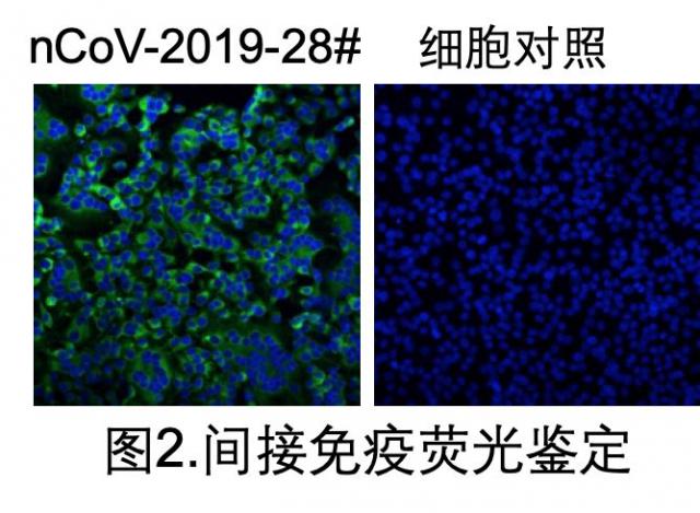 [半岛晨报]钟南山团队的这个最新发现，需要大家警惕！