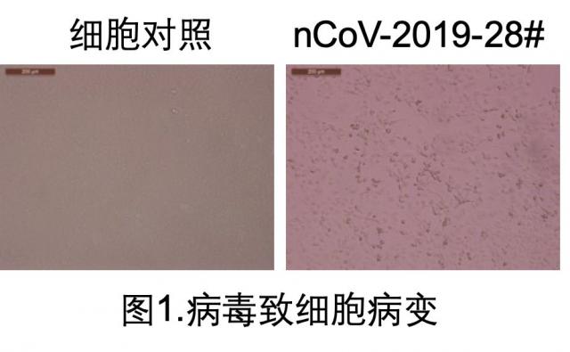 [半岛晨报]钟南山团队的这个最新发现，需要大家警惕！