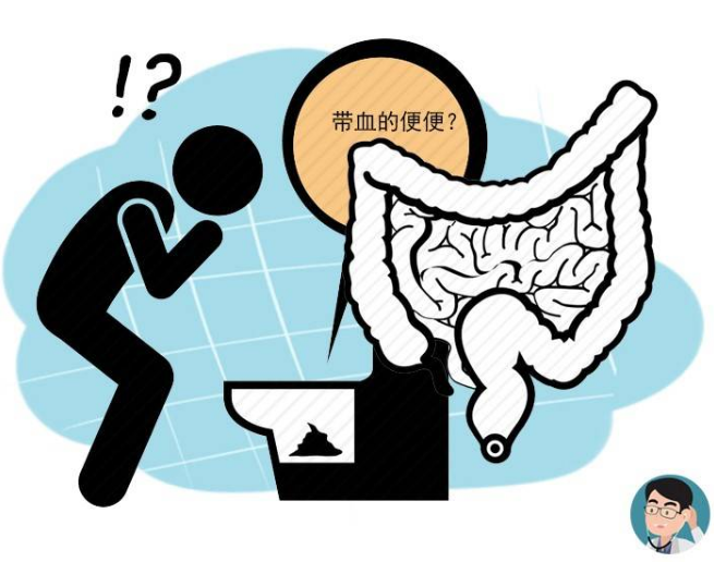 腹泻不止以为是胃肠炎出现这些异常或是肠癌的信号