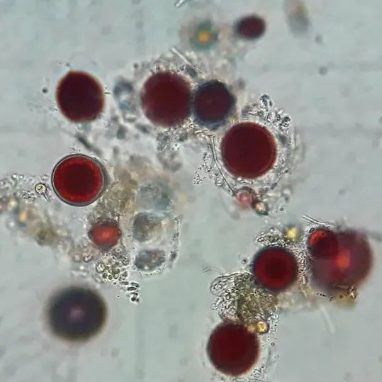 显微镜下的极地雪藻