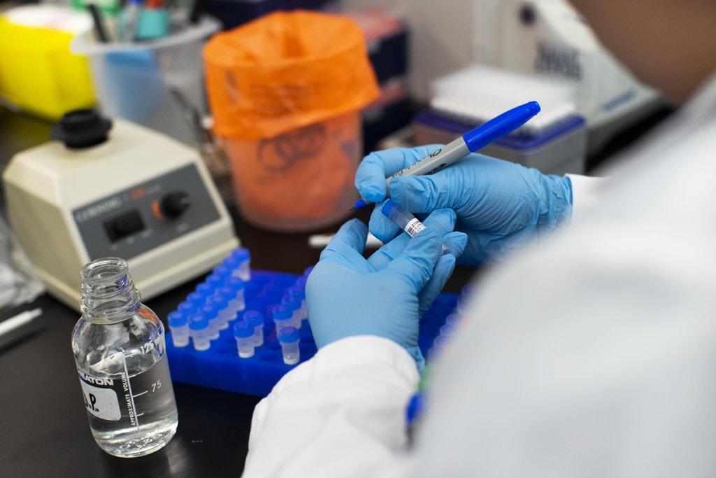 fda▲美国FDA放宽审查程序 紧急提升全美新冠病毒检测效能