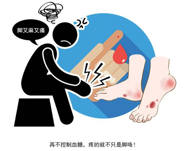血糖高不高脚知道脚上若出现3痛2痒说明血糖已飙升