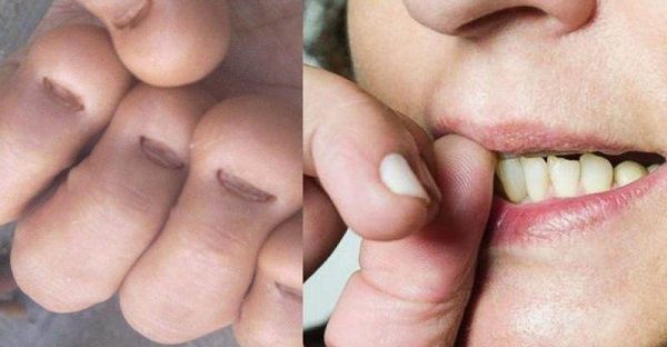 孩子经常咬指甲?并非是缺少维生素,真正原因很多妈妈不知道