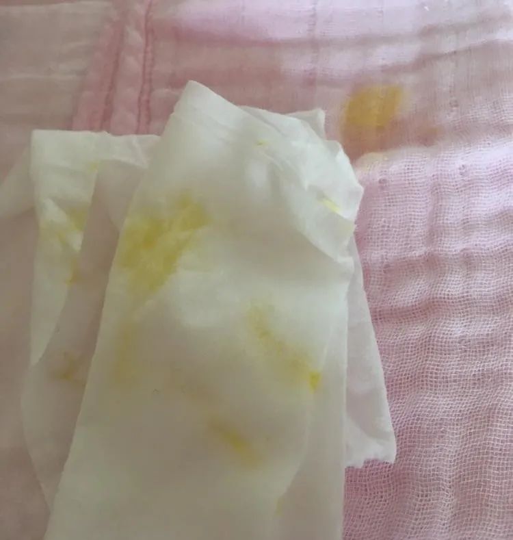 一文读懂丨宝宝吐奶块奶瓣豆腐渣样奶水样奶原样奶情况
