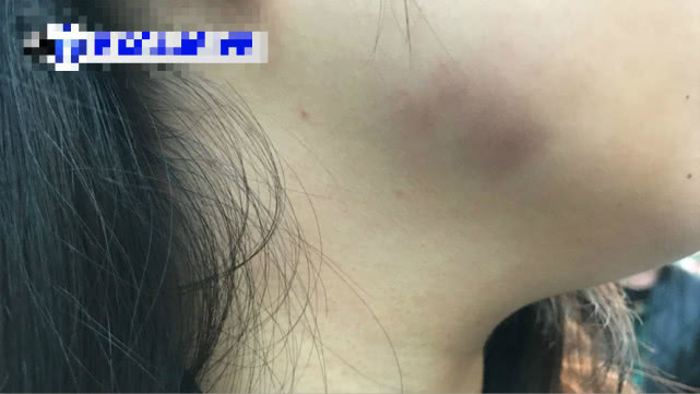 【国际社会】又一起！因疫情遭遇种族偏见 纽约一亚裔女性被当街殴打