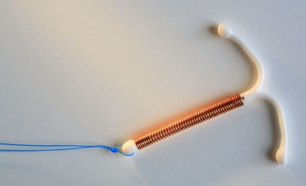 宝宝"攥着"节育环出生,连医生都惊讶!为啥上了环还会怀孕?