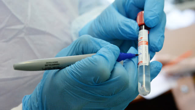 【国际】俄罗斯宣布已进行约80万人次新冠病毒检测