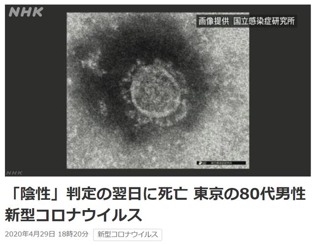 #国际#日本一感染者生前检测呈阴性 次日病情急剧恶化死亡