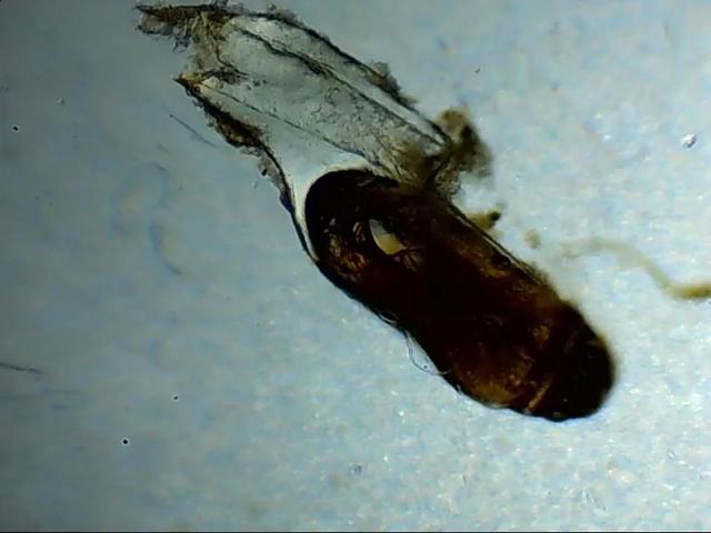 生活■活久见！2岁女孩睫毛密密麻麻长出这了这些，医生都惊呆了