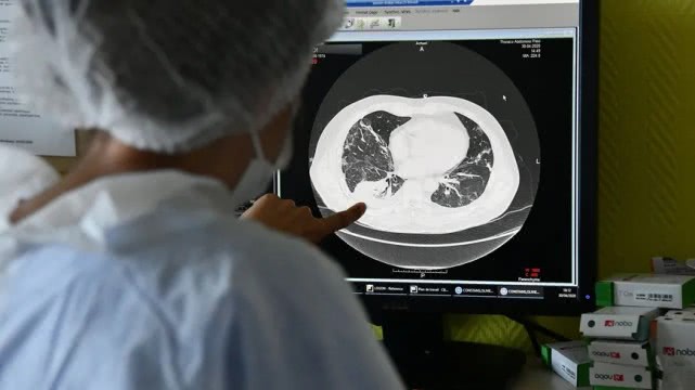 国际社会法媒：医院经检查发现法国去年11月已出现疑似新冠病例