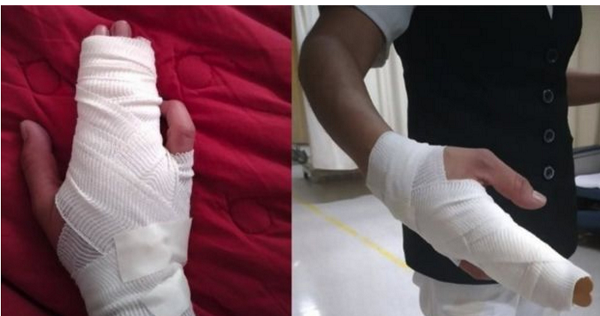 国际社会抗疫英雄成为暴力牺牲品 墨西哥各方敦促立法保护医护人员