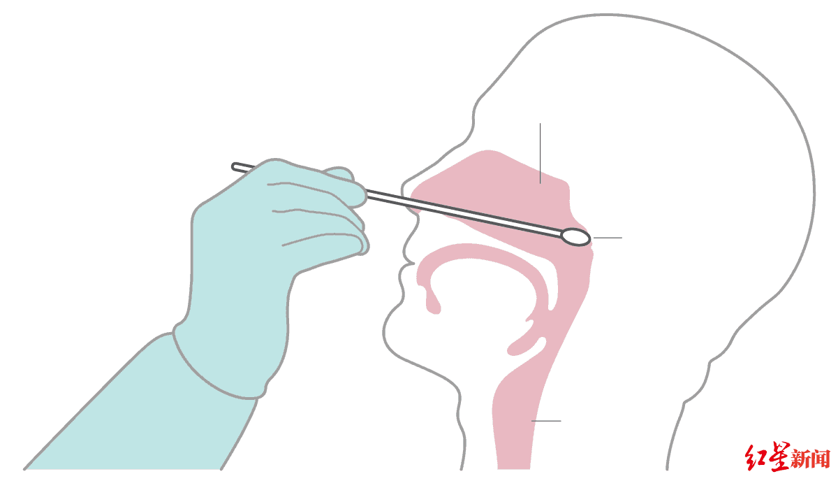 国际白宫使用的这种新冠检测盒漏掉一半阳性病例?FDA发布警告