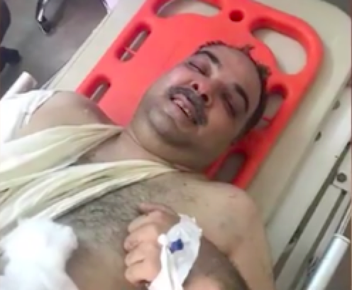 客机奇迹！失事客机发现2名幸存者