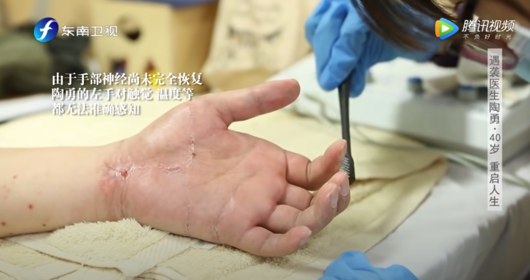 社会|他的“复出”，让我心疼