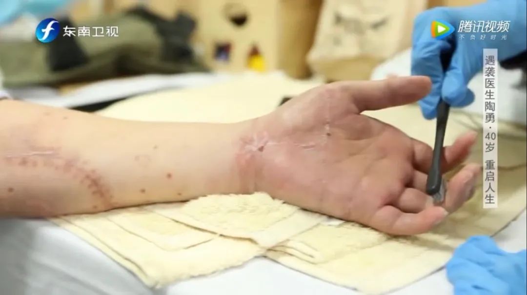 社会|他的“复出”，让我心疼