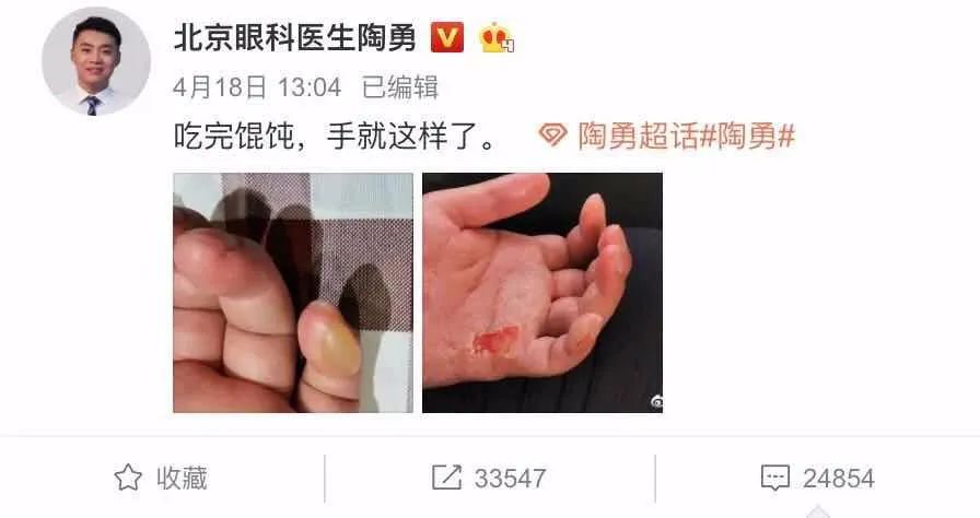 社会|他的“复出”，让我心疼