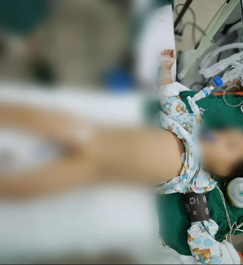 4岁男童饭后做了这个动作,一肚子小肠全变黑,被切除1米半!