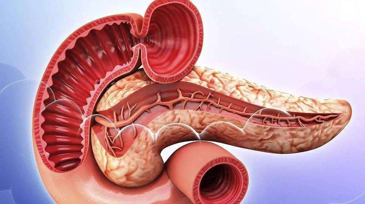 急性胰腺炎