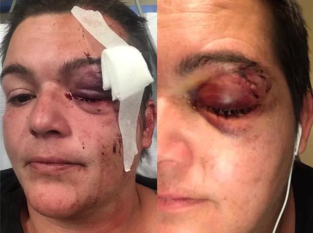 催泪瓦斯|射击、催泪瓦斯、骑马踩踏……美国警察用了这些手段