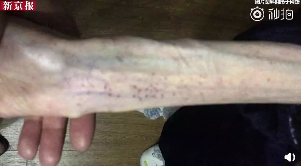 视觉志|200斤女孩被嫌弃的一生。｜百家故事