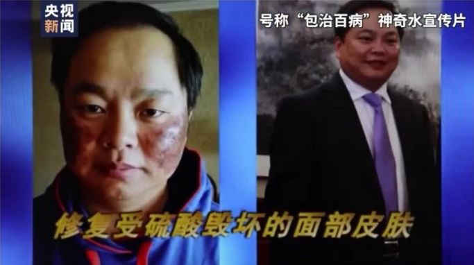 养生|别被你朋友圈的「养生大师」骗了！｜百家故事