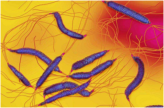 幽门螺杆菌|幽门螺杆菌感染,3种食物大胆吃,坚持住胃就赢了,不痛不反酸