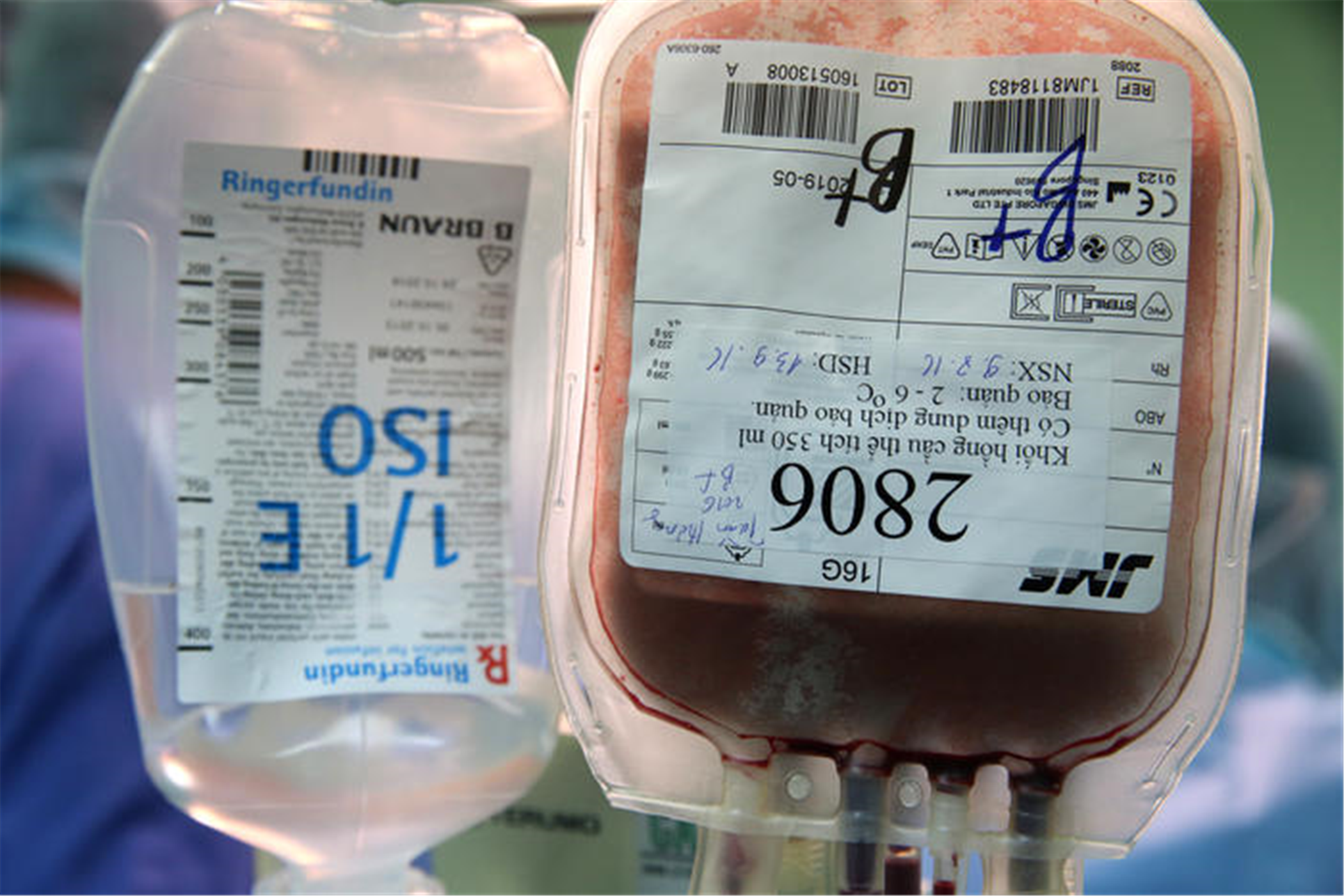 最后是维持患者的凝血功能,可输注血小板,新鲜冰冻血浆或其他血液成分