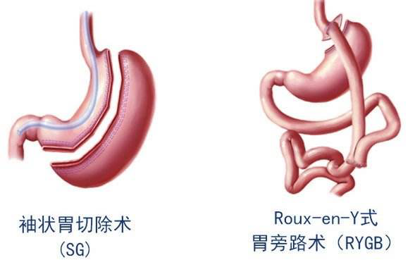 关晓彤|关晓彤被骂、马思纯抑郁：「肥胖羞辱」将多少女孩逼上绝路？！