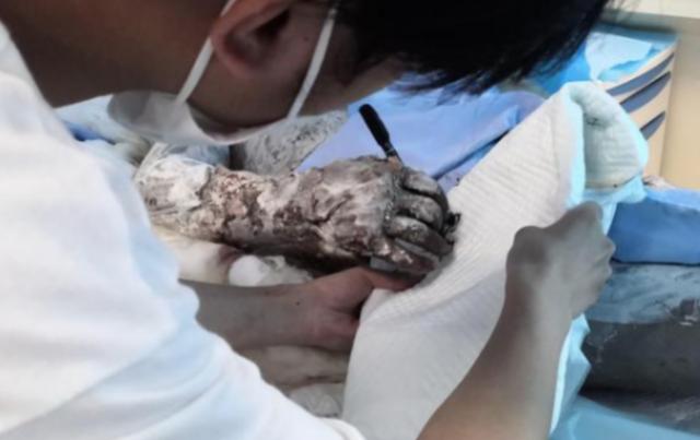 婚姻|女子感染新冠，被丈夫推下5楼：嫁错人，真的会要命