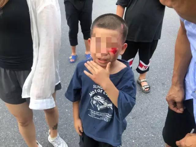 社会|司机刚启动车子，突然从车底传出一声尖叫！