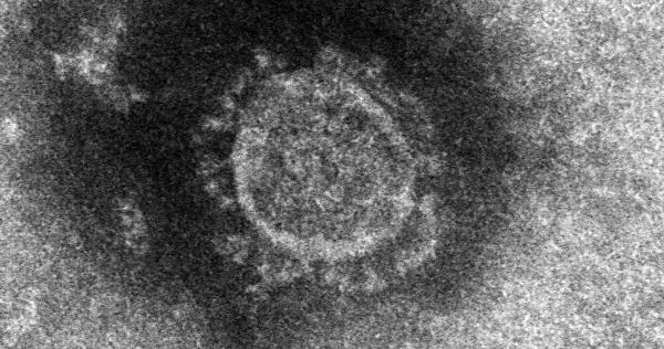 国际|日本单日新增感染病例首次破千,多地感染人数再创新高
