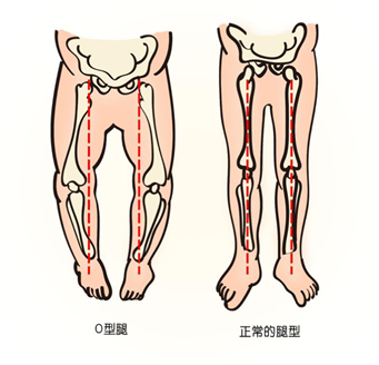 生活|这个很“舒服”的动作,千万不要超过15分钟!|精选
