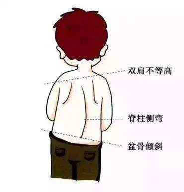 生活|这个很“舒服”的动作,千万不要超过15分钟!|精选