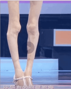 减肥|29岁女孩为爱减肥，曝光身材引争议：你的时间有限，不要为别人活