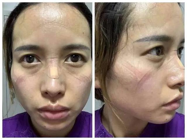 黄雯|“不要睡，醒来！”援鄂归来护士又出手了